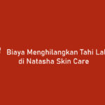 Biaya Menghilangkan Tahi Lalat di Natasha Skin Care